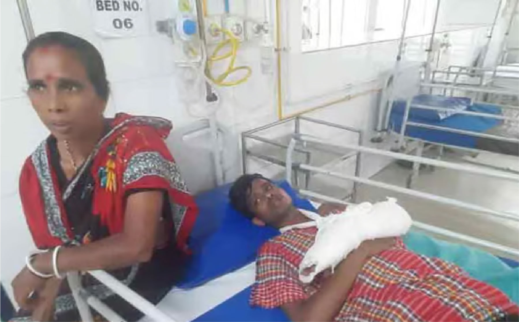 বিরল স্পাইনাল মাসকুলার অ্যাট্রোফি